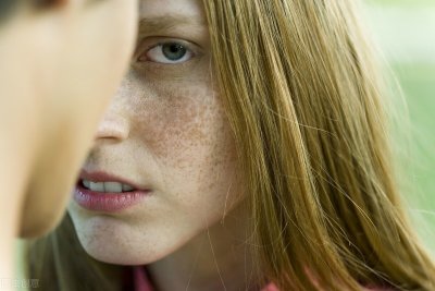 ​面部黄褐斑的治疗方法 脸上有黄褐斑不自信，这2种去除斑方法，分分钟学会