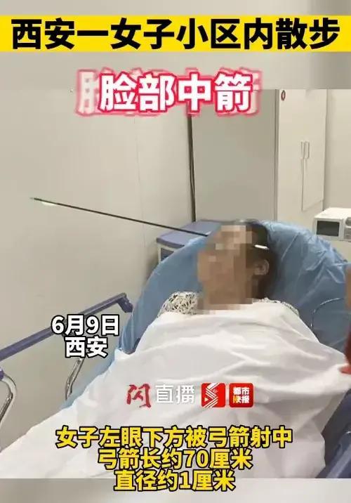 士兵被弓箭射穿腹部（陕西一女子竟被弓箭射穿脸部）(1)