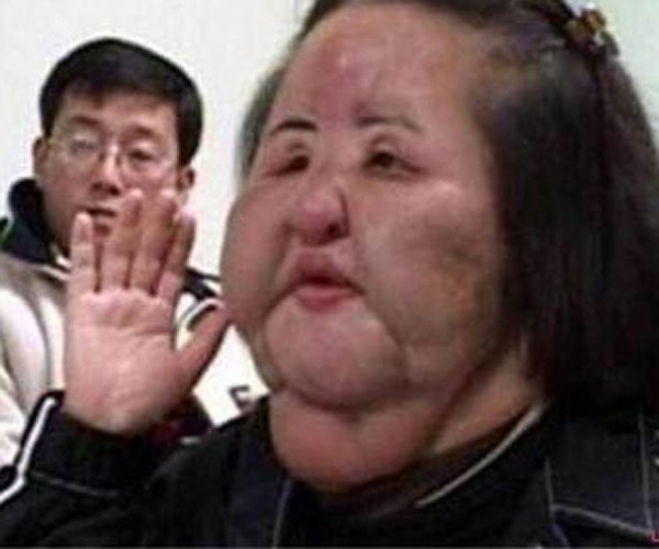 韩苗可整容前后的样子对比 那个超级失败的案例