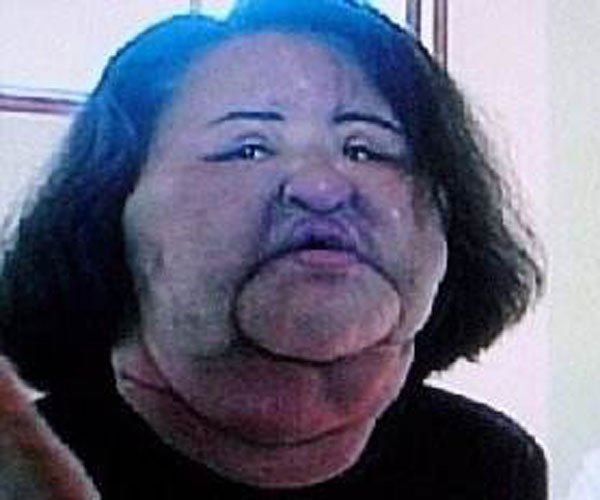 韩苗可整容前后的样子对比 那个超级失败的案例