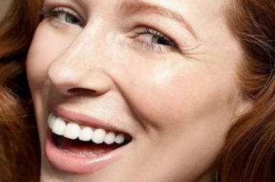 ​鱼尾纹是什么样子 鱼尾纹是桃花纹吗