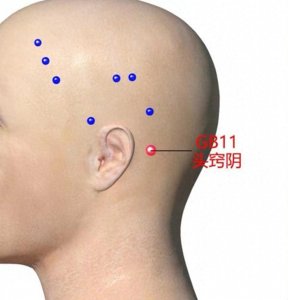 ​中医穴位小妙招：头窍阴穴——耳聋、耳鸣，听不清就按头窍阴